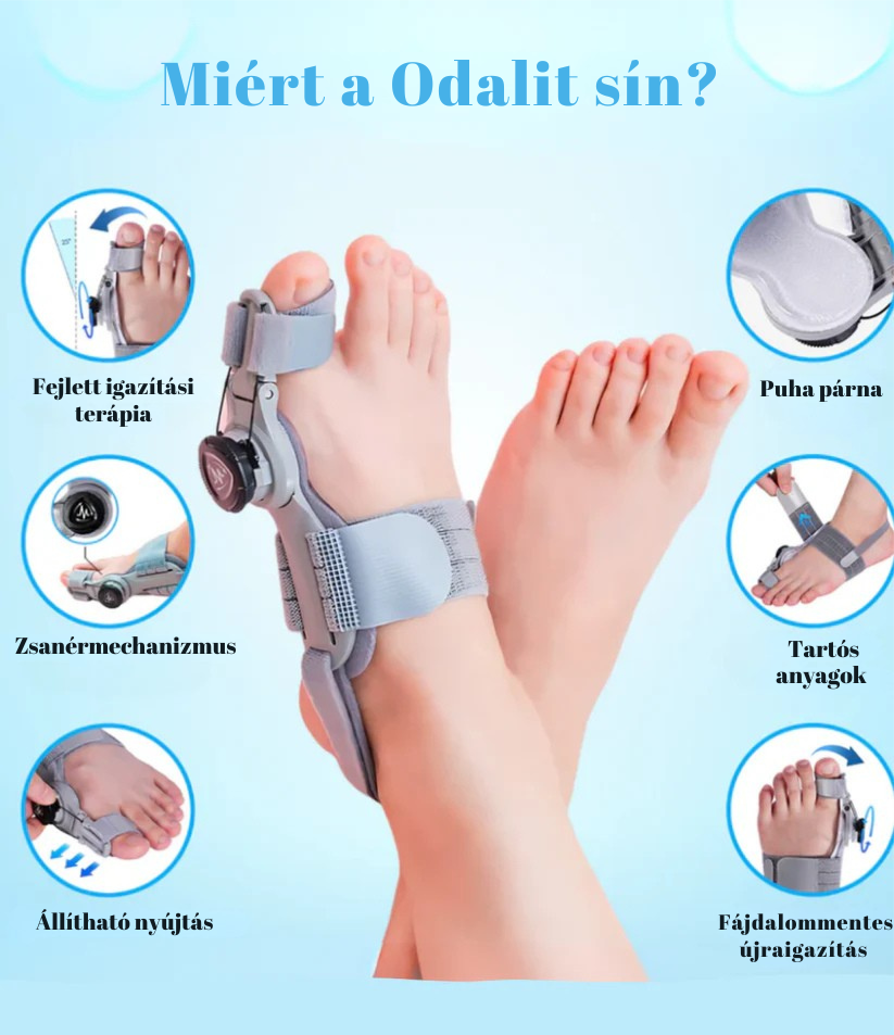 Hallux Valgus sín