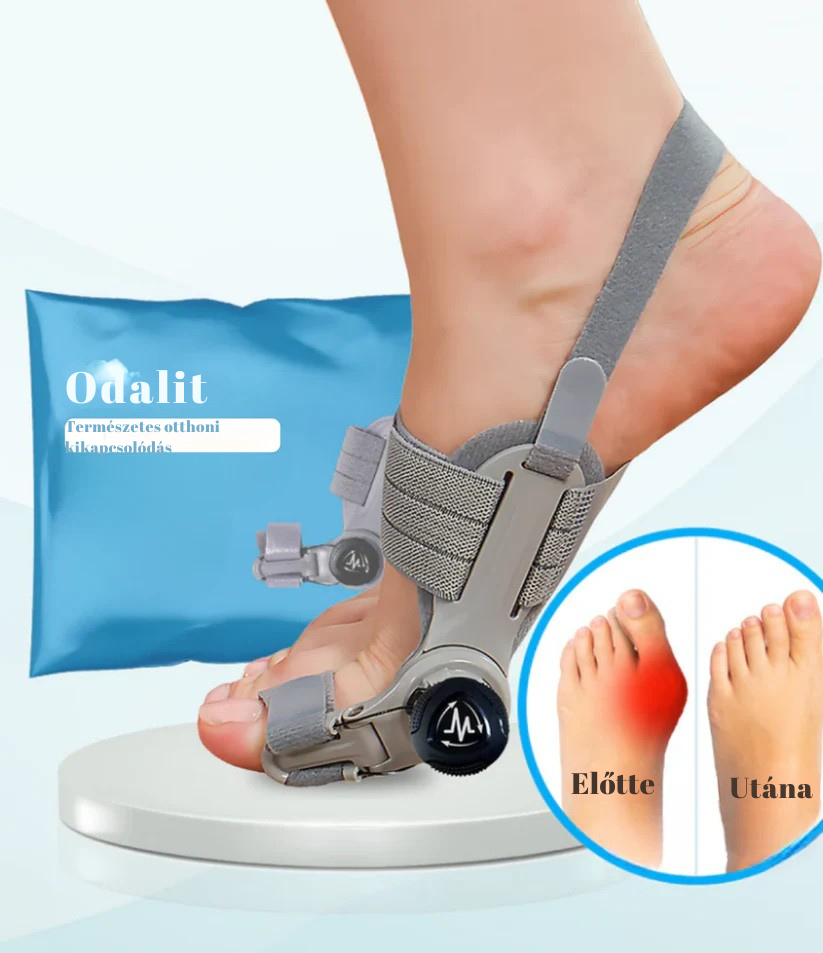 Hallux Valgus sín