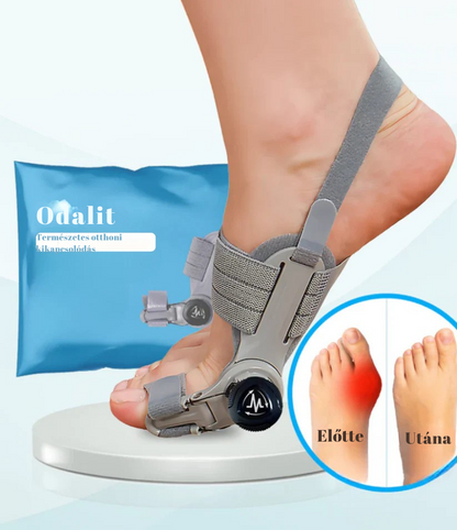 Hallux Valgus sín