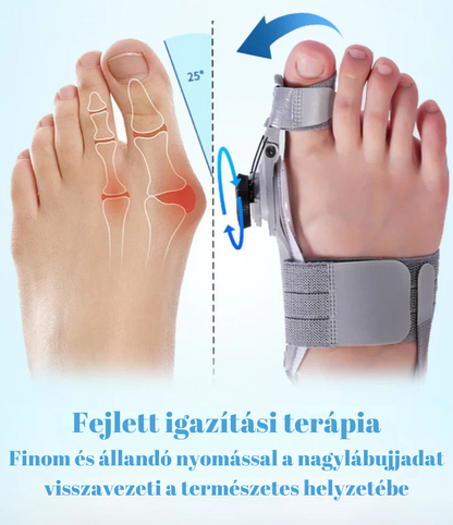 Hallux Valgus sín